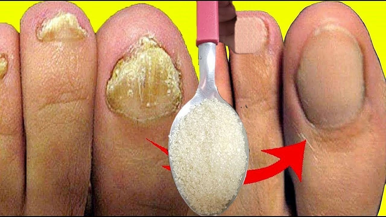 Joga Na Unha Podre E Velha: As Manicures Vão Me Detestar Depois Disso, Apenas 2 Dias!