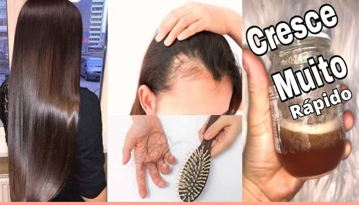 Isso faz crescer cabelo e para de cair! 2 Receitas Poderosas